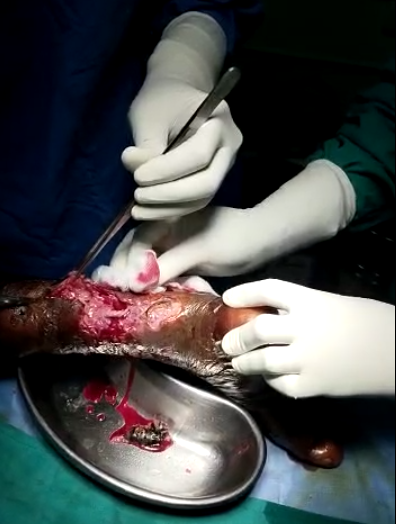 Case Study 1- During Surgery